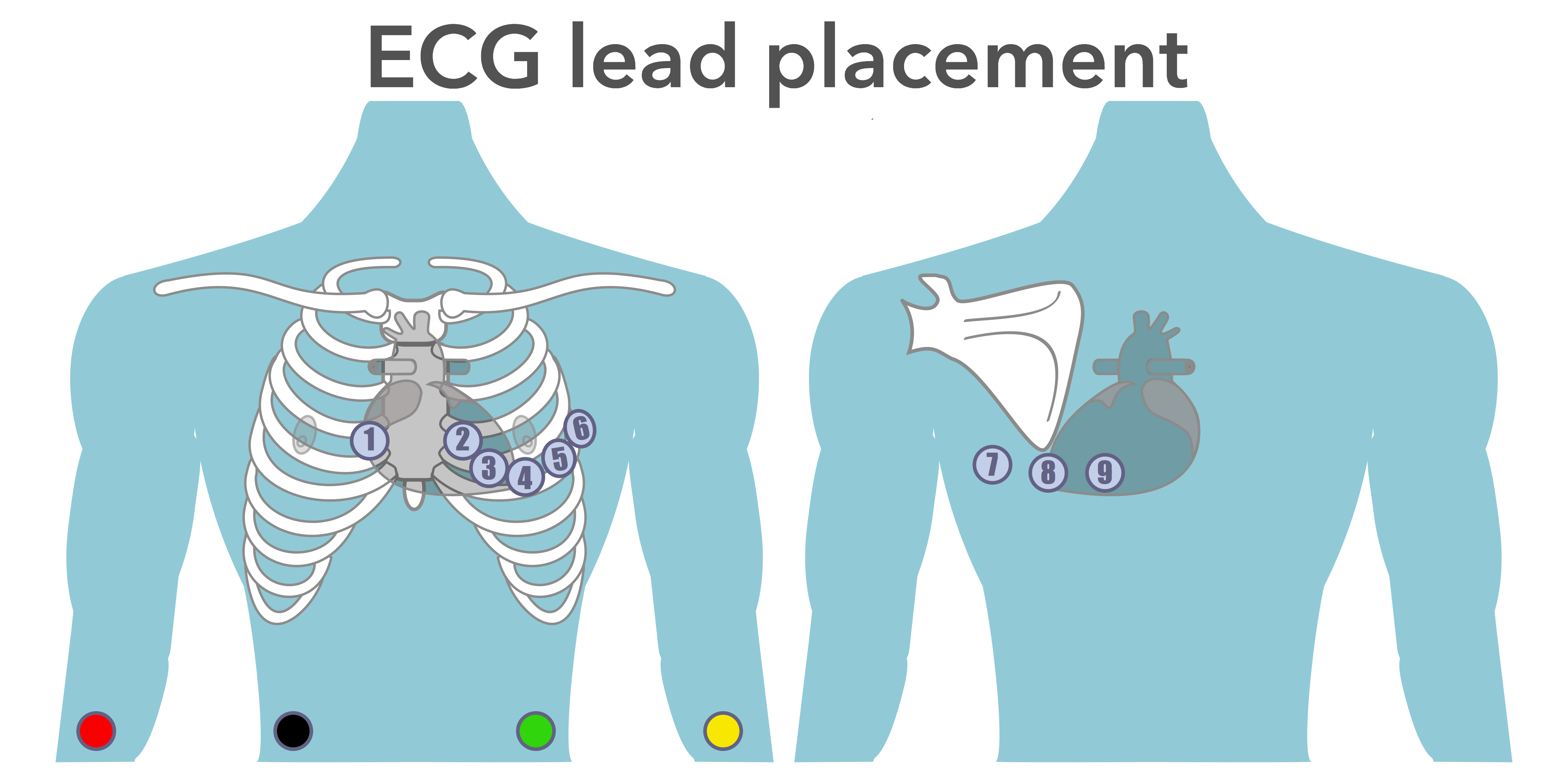 ECG Placement & Mis-LEADing ECG’s – EMbeds.co.uk